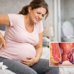 Praktični saveti kako odabrati najbolji gel za hemoroide u trudnoći